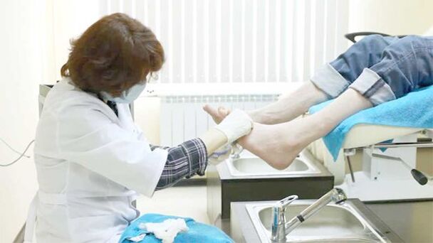 A dermatologist treats toenail fungus