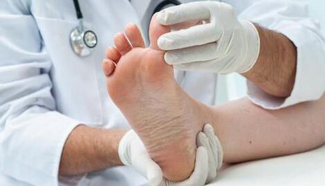 Treatment of fungus