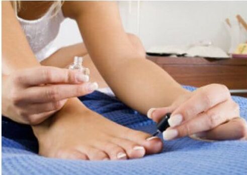 treating toenail fungus with nail polish